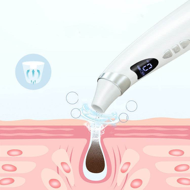 VACu Skin Vacuum–Deep Cleansing & Blackhead Removal for Flawless Skin